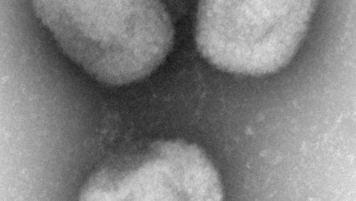 Microscope image of a new virus known as Akhmeta, after the eastern European region where it was first detected. The germ is related to the dreaded smallpox and monkeypox viruses but so far seems far less threatening. A Dallas resident has been hospitalized in stable condition under isolation after returning from Nigeria with the first Texas case of monkeypox, health officials revealed Friday. (AP Photo/CDC via The New England Journal of Medicine, Cynthia Goldsmith, Maureen Metcalfe)