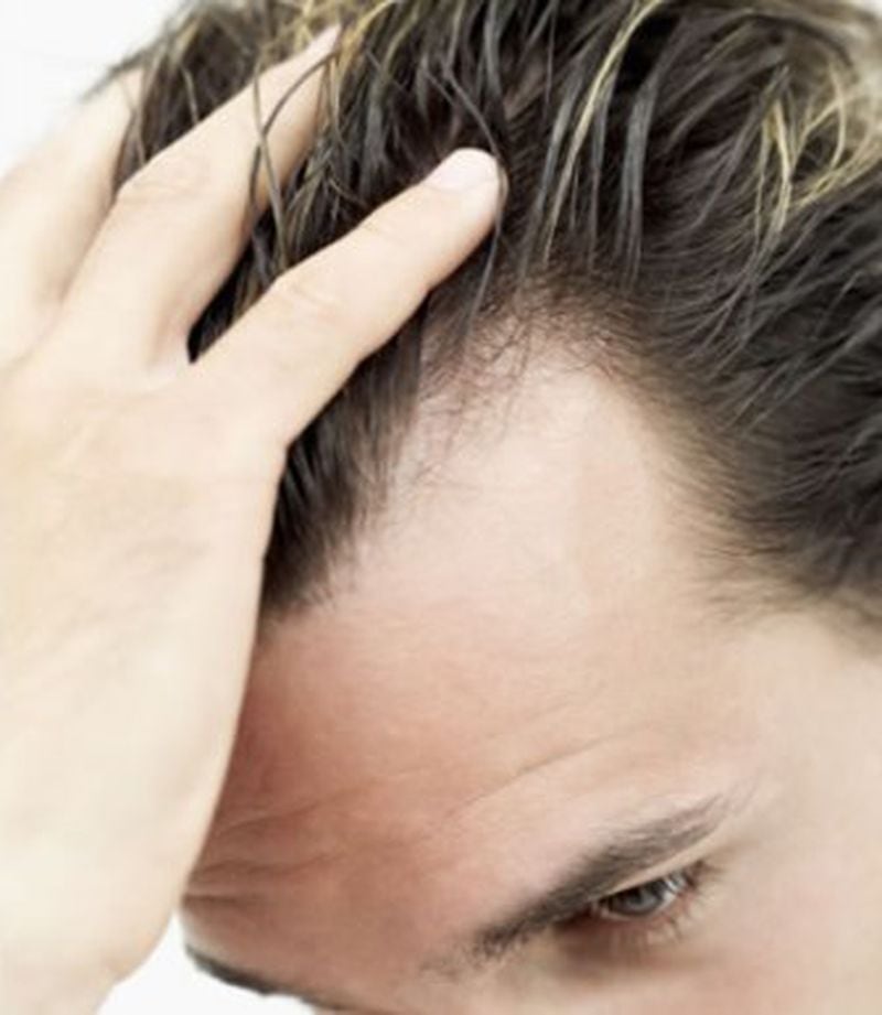 Hair loss can have a negative effect on self-esteem.