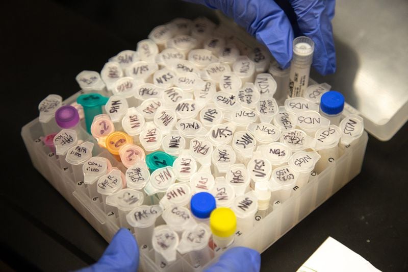 Senior biology student Jessica Nix, who’s assisting with bladder cancer research, organizes samples in her University of North Georgia lab. STEVE SCHAEFER / SPECIAL TO THE AJC