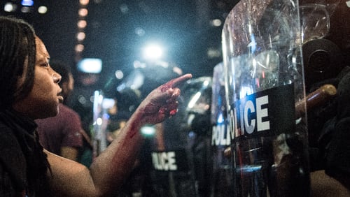 With blood covering her hand and arm, a woman points at a police officer on September 21, 2016 in Charlotte, N.C., in response to the fatal shooting by police officers of 43-year-old Keith Lamont Scott.