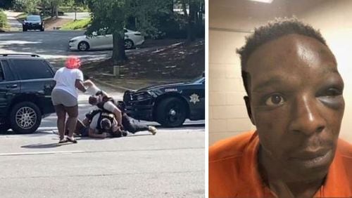 A Clayton County deputy has been fired after cellphone video surfaced that appears to show him repeatedly punching a man during an arrest. A photo shared by Roderick Walker's attorney shows him with a black eye while wearing an orange jail jumpsuit.
