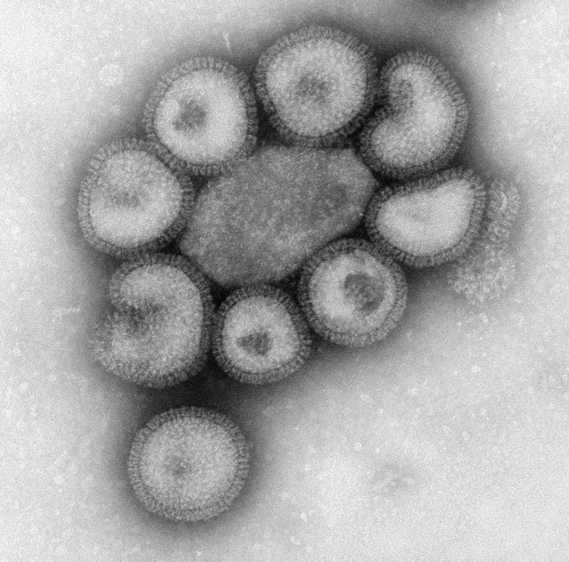 This 1973 electron microscope image made available by the Centers for Disease Control and Prevention shows influenza virus particles. (Dr. F. A. Murphy/CDC via AP)