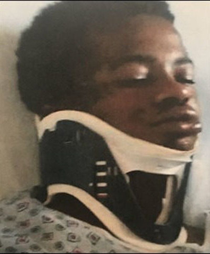 The teen suffered a concussion after being assaulted by a former Atlanta police officer in 2016.