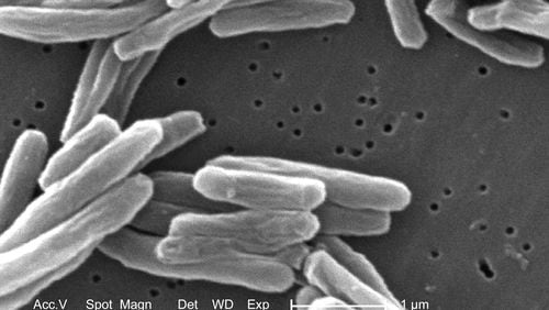 This 2006 electron microscope image provided by the Centers for Disease Control and Prevention shows Mycobacterium tuberculosis bacteria, which causes the disease tuberculosis. The number of U.S. tuberculosis cases in 2023 was the highest in a decade, according to a report released by the CDC on Thursday, March 28, 2024. (Janice Carr/CDC via AP)