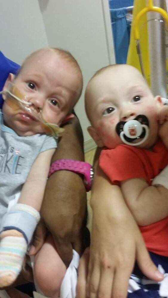 Formerly conjoined twins Carter and Conner