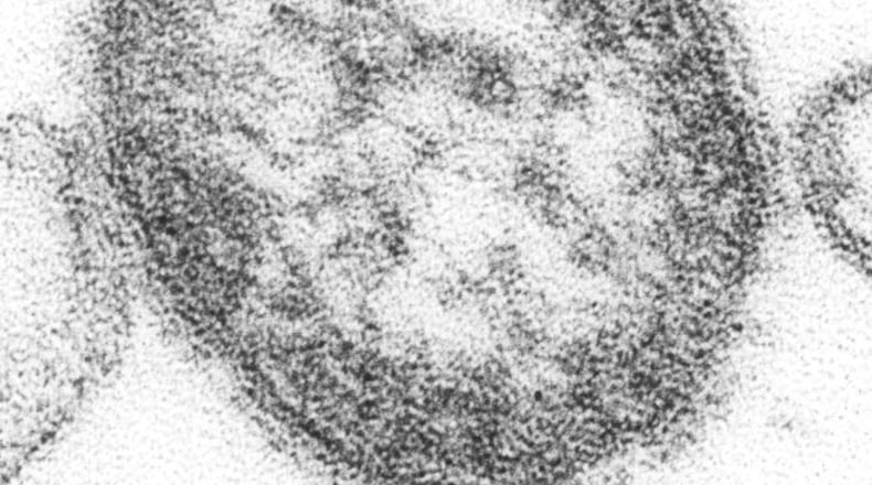 The measles virus. (Photo courtesy of U.S. Centers for Disease Control and Prevention/Cynthia Goldsmith)