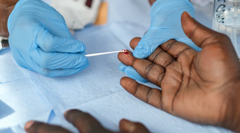 FILE — A blood test for HIV and hepatitis C is taken at a mobile clinic in Nashville, Tenn., March 1, 2023. The Department of Health and Human Services is now considering shutting down the HIV prevention division of the Centers for Disease Control and Prevention and shifting some of its activities to a different agency, according to federal officials. (Kevin Wurm/The New York Times)