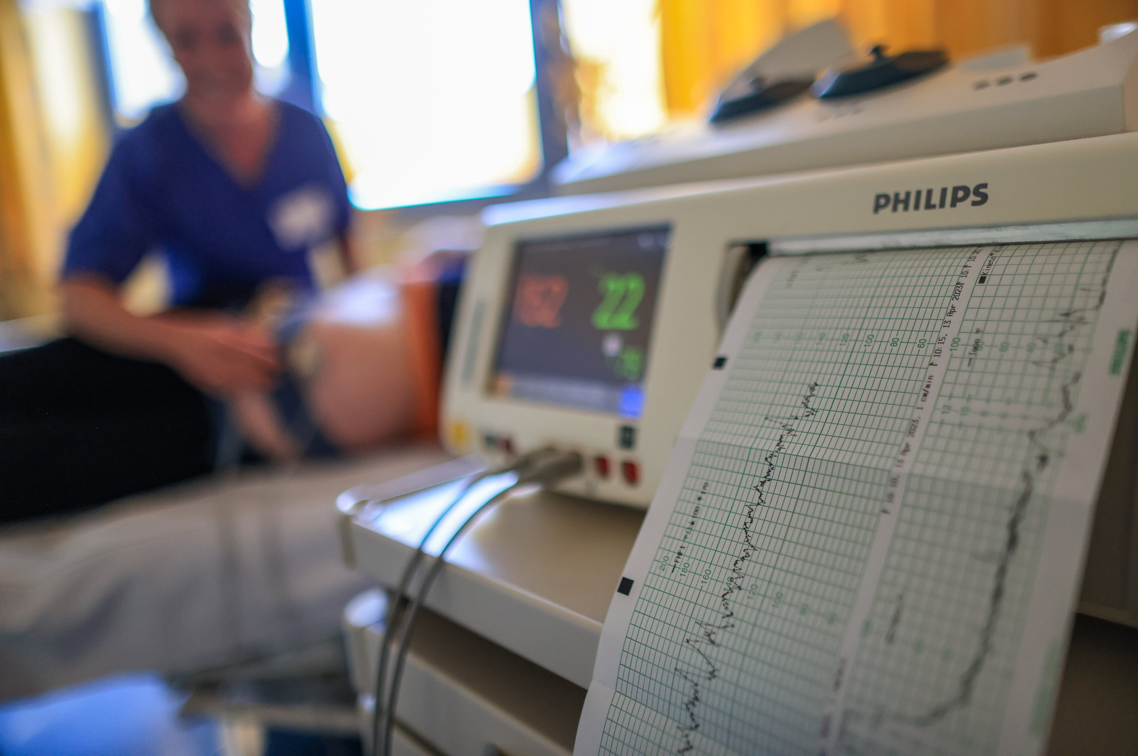 Development of cesarean section numbers