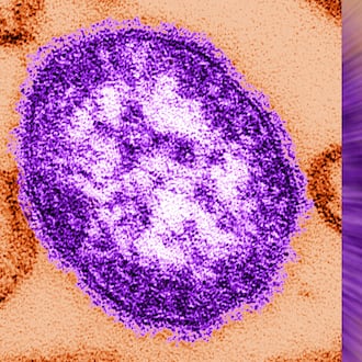 An electron microscope image of a measles virus particle. (Cynthia Goldsmith/Centers for Disease Control and Prevention via AP)