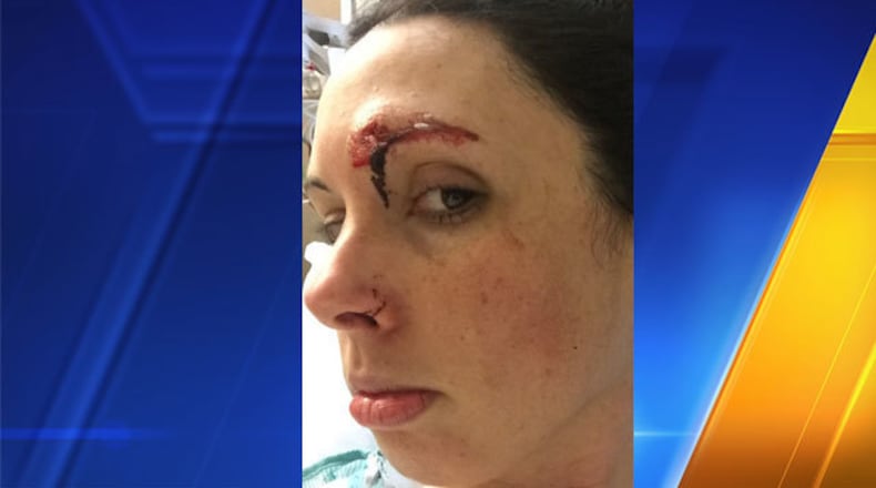 Police say Kelly Herron was attacked by a homeless sex offender inside a public bathroom at a popular park in Seattle. (KIRO/Cox Media Group)