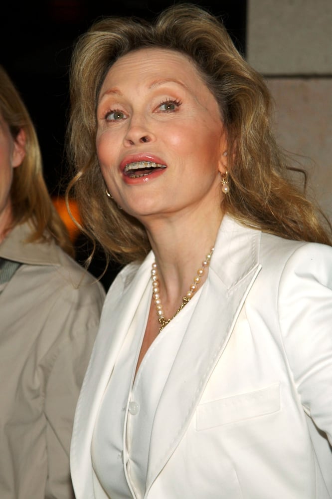 Celebrities who have had braces