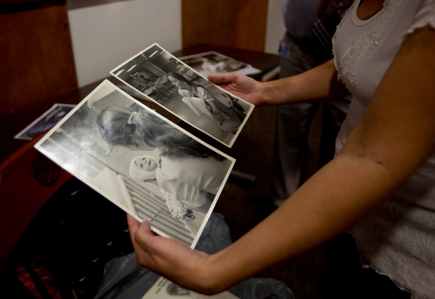 Burned as baby, woman finally meets nurse who cared for her