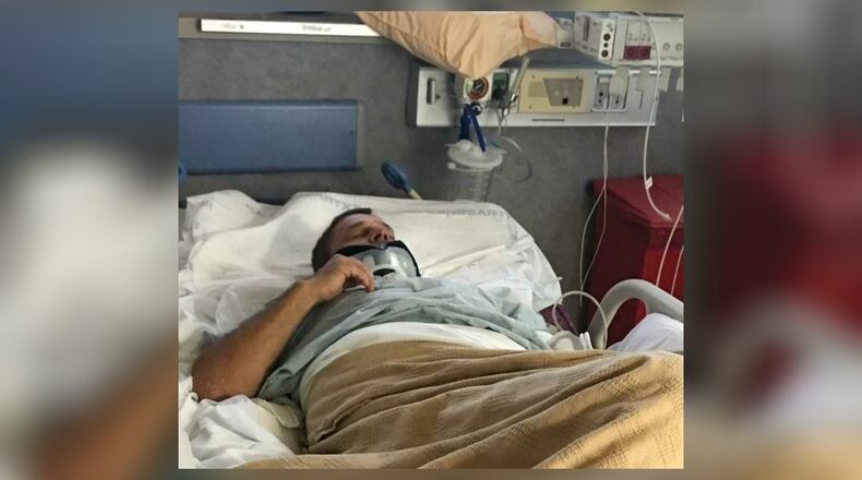 Travis Abbott was hit with a steel bar during a road-rage incident in Spalding County.