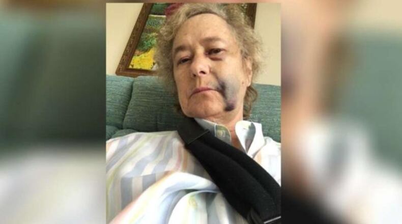 Sheryl Cohen was hurt outside a theater in Boynton Beach, Florida.