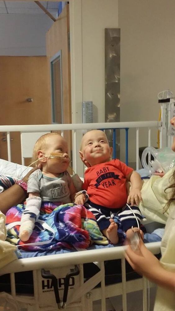 Formerly conjoined twins Carter and Conner