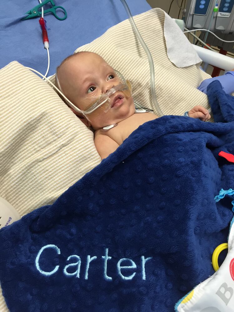 Formerly conjoined twins recovering well after separation surgery