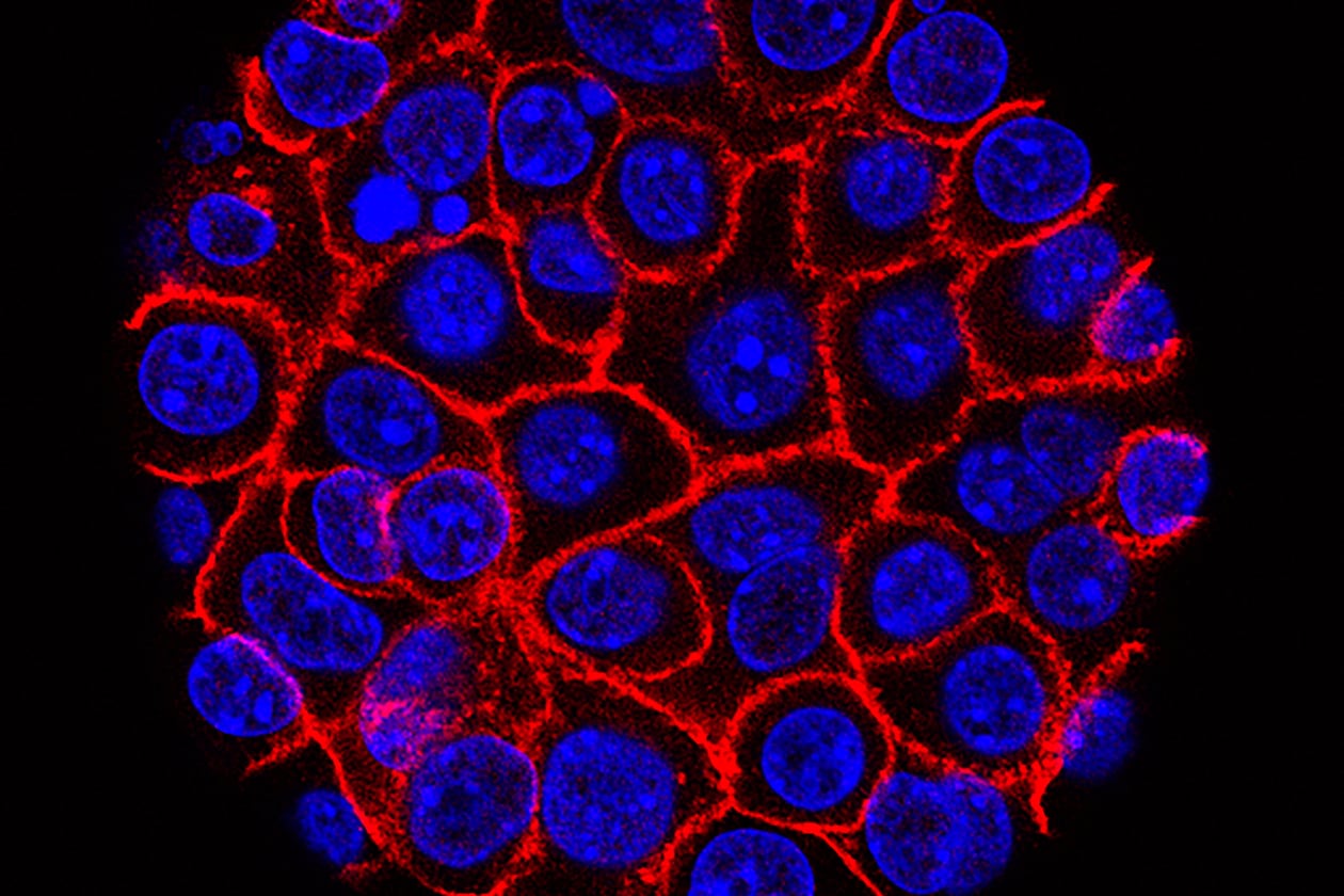 This undated microscope image from USC via the NIH shows pancreatic cancer cells, nuclei in blue, growing as a sphere encased in membranes, red. (Min Yu/Eli and Edythe Broad Center for Regenerative Medicine and Stem Cell Research at USC, USC Norris Comprehensive Cancer Center, File)