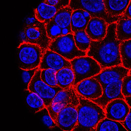 FILE - This undated microscope image from USC via the NIH shows pancreatic cancer cells, nuclei in blue, growing as a sphere encased in membranes, red. (Min Yu/Eli and Edythe Broad Center for Regenerative Medicine and Stem Cell Research at USC, USC Norris Comprehensive Cancer Center, File)