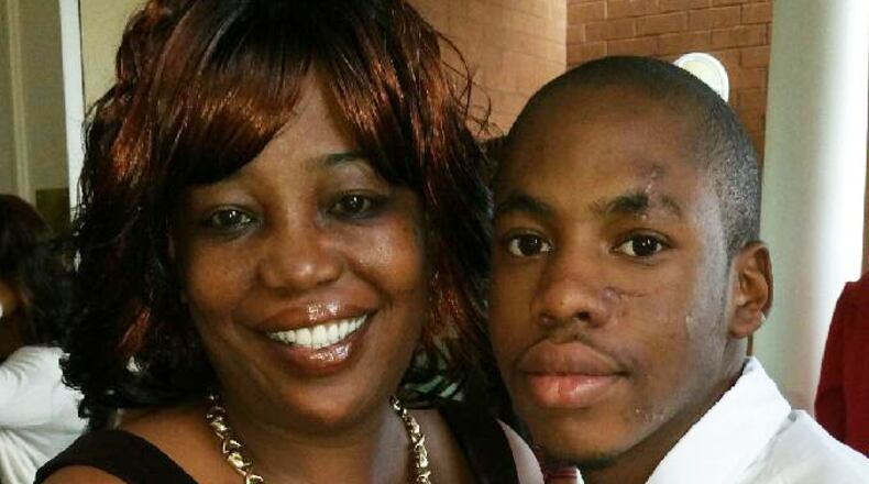 Sandra Mathis and son Michael Price, who the mother says is disabled and was hit by a car while walking to a DeKalb County Schools bus and now has facial scarring, along with metal parts in his arm and leg. The mother is suing the district. (Family Photo)