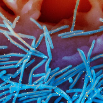 FILE - This electron microscope image provided by the National Institutes of Health shows human respiratory syncytial virus (RSV) virions, colorized blue, and anti-RSV F protein/gold antibodies, colorized yellow, shedding from the surface of human lung cells. (National Institute of Allergy and Infectious Diseases, NIH via AP, File)