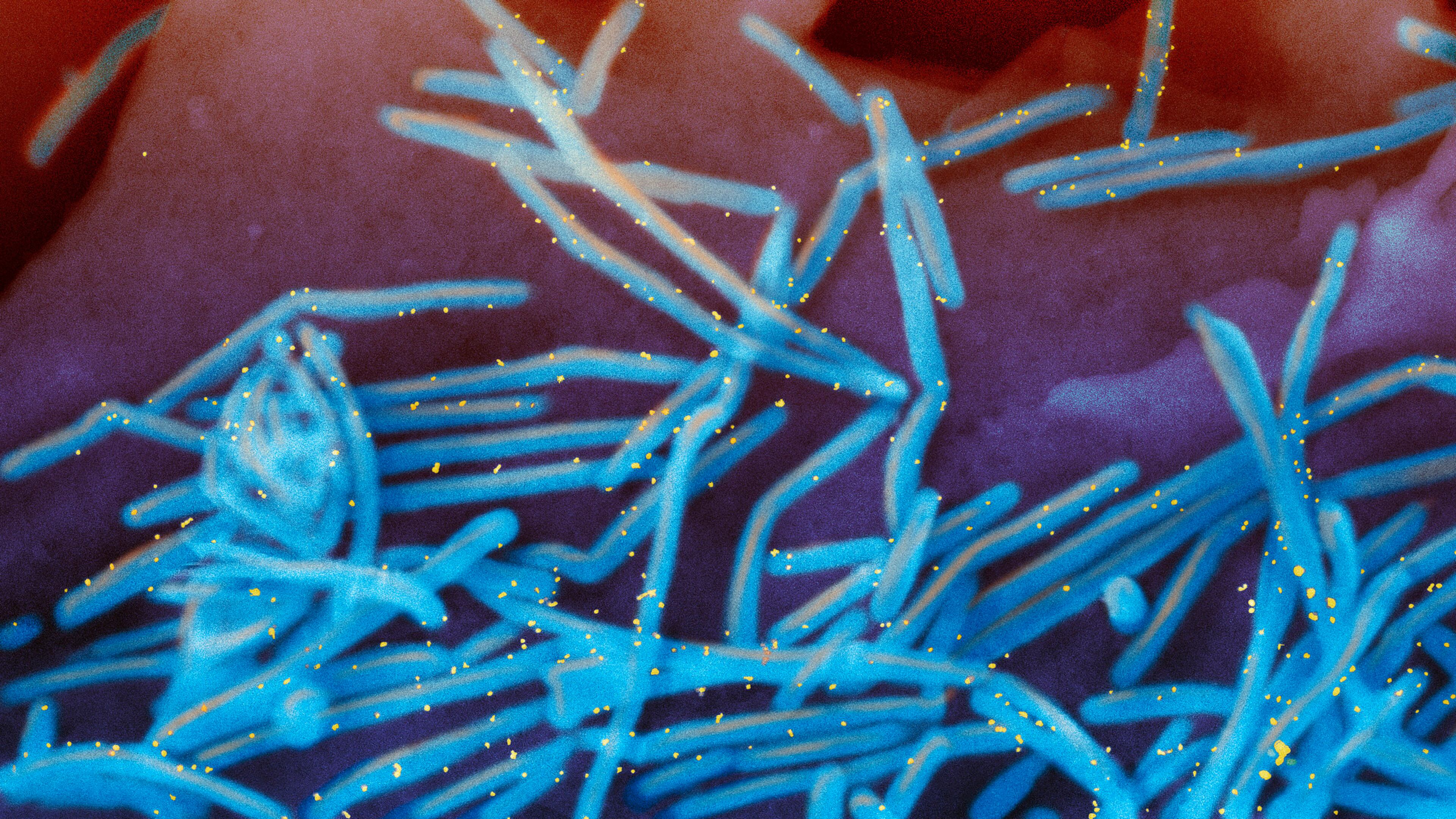 FILE - This electron microscope image provided by the National Institutes of Health shows human respiratory syncytial virus (RSV) virions, colorized blue, and anti-RSV F protein/gold antibodies, colorized yellow, shedding from the surface of human lung cells. (National Institute of Allergy and Infectious Diseases, NIH via AP, File)