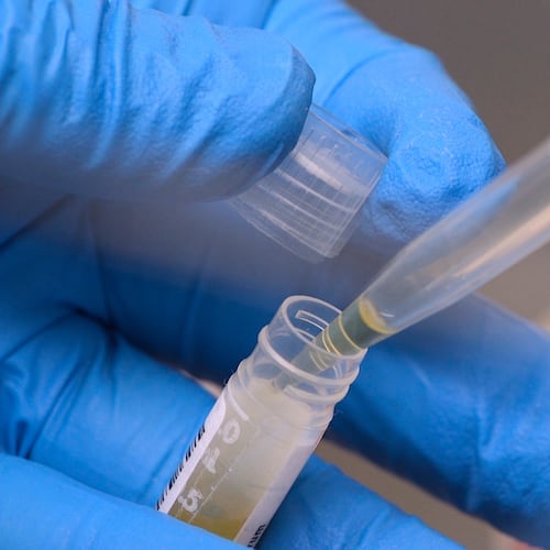 FILE - National Institute of Health researchers test patient samples in Bethesda, Md., on Nov. 20, 2019. (AP Photo/Federica Narancio, File)