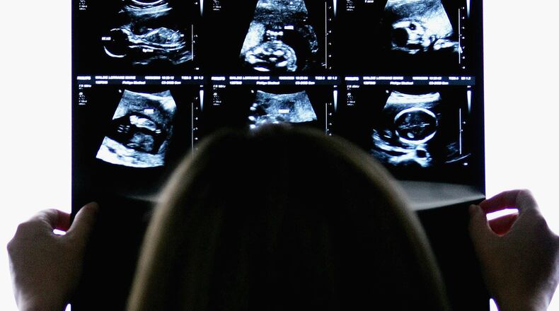 (Photo by Ian Waldie/Getty Images)