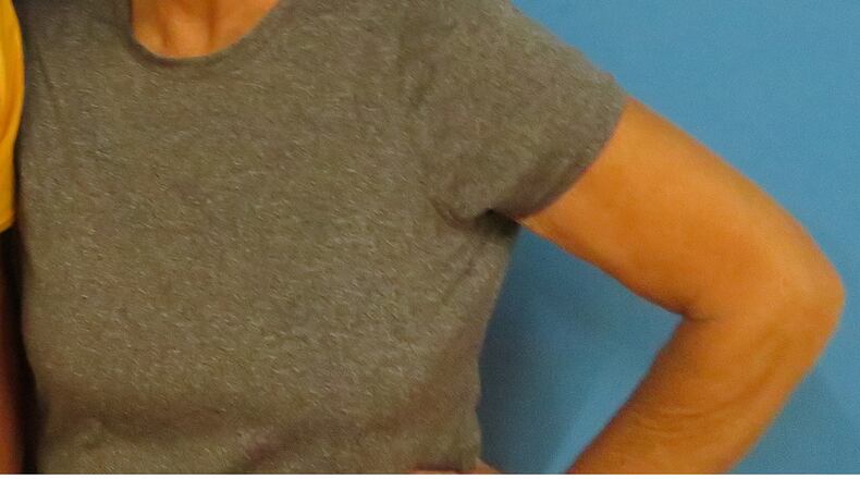 Sherry Deaton, 71, joined the Silver Sneakers program to improve her mobility. “Weight loss is not the only reason to get into shape," she said. "It will make you feel better.” Courtesy of Sherry Deaton