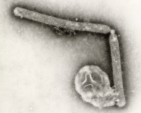 This undated electron microscopic image provided by the Centers for Disease Control and Prevention shows two Influenza A (H5N1) virions, a type of bird flu virus. (Cynthia Goldsmith, Jackie Katz/CDC via AP)