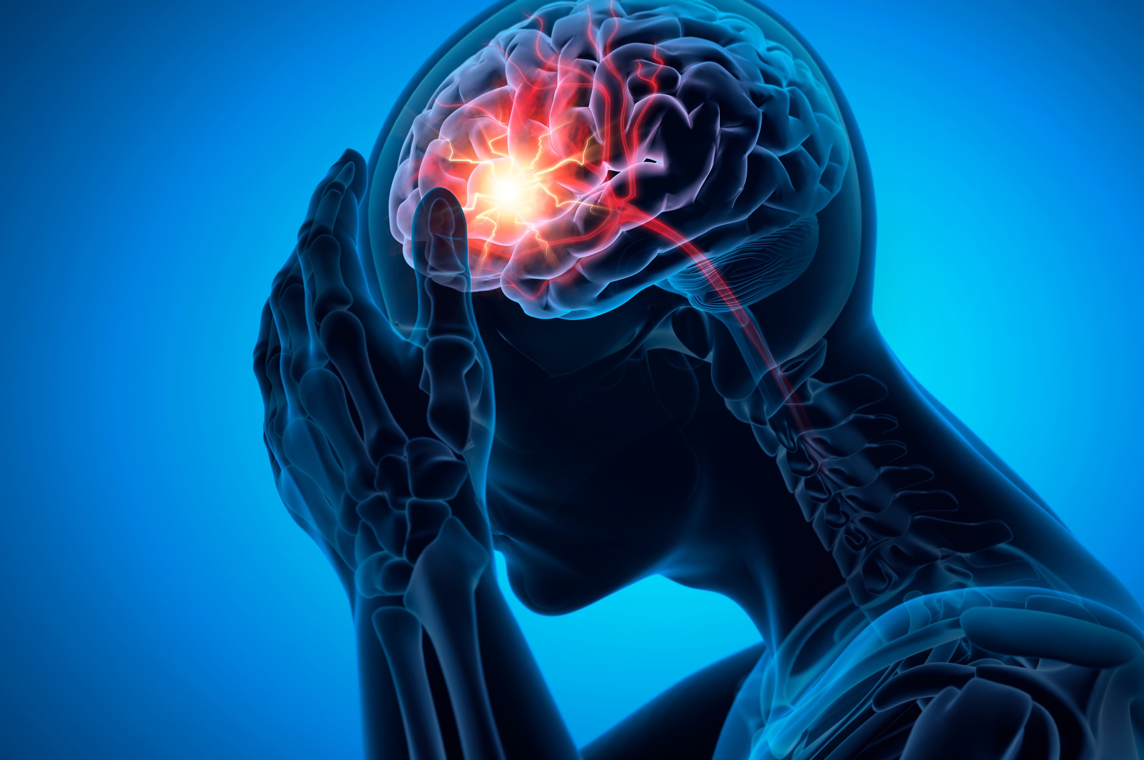 Brain Stroke 3D Illustration