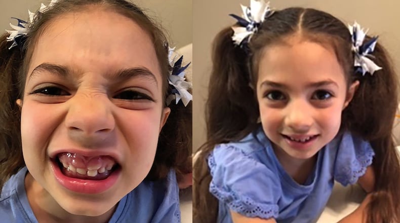 When 6-year-old Rosie Weishar’s two permanent teeth erupted, they crowded her baby teeth. But her mom had to wait weeks to take her to the dentist, because offices were closed to all but emergency dental work.