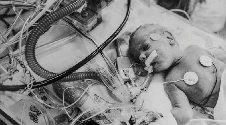 A 1-month-old boy, addicted to cocaine at birth, breathes with the help of a ventilator in an incubator at Grady Memorial Hospital. He was born eight to 10 weeks premature. (Walter Stricklin/AJC file)