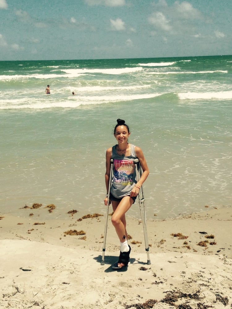 Photos: Seminole County girl bitten by shark