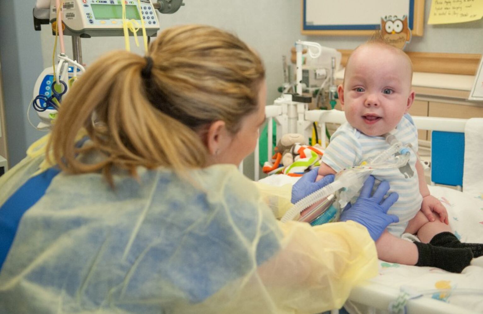 Separated conjoined twins released from Dallas hosptial