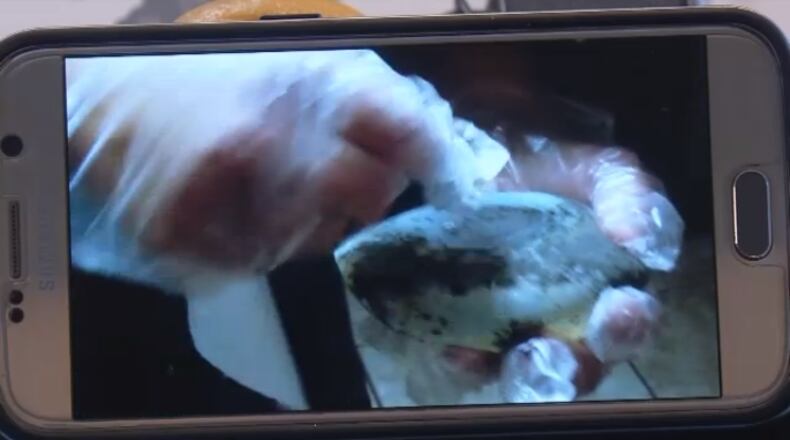 The mold-covered implants Anne Ziegenhorn said caused years of pain / Courtesy: WEAR-TV