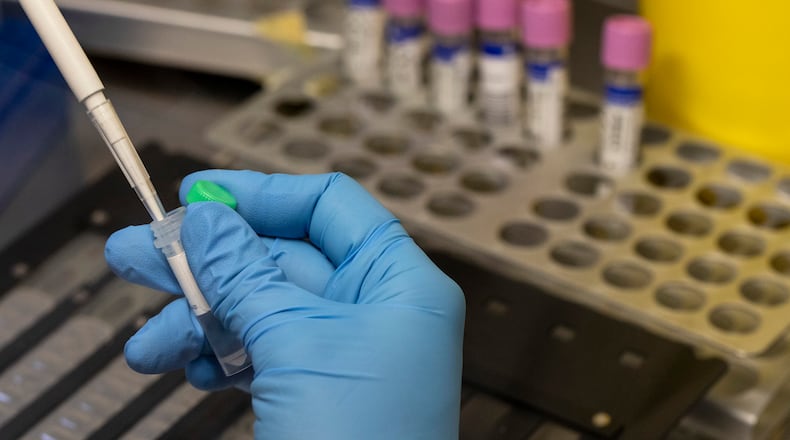 A medical laboratory technician inactivates suspected monkeypox samples to be PCR tested at the microbiology laboratory of La Paz Hospital on June 6, 2022 ,in Madrid, Spain. (Pablo Blazquez Dominguez/Getty Images/TNS)