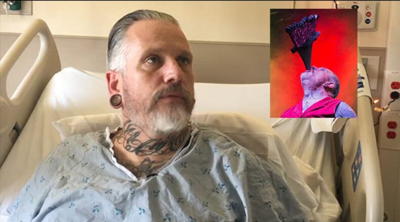 Chris Steele was injured while performing a familiar stunt involving 13 swords, he told Channel 2 Action News.