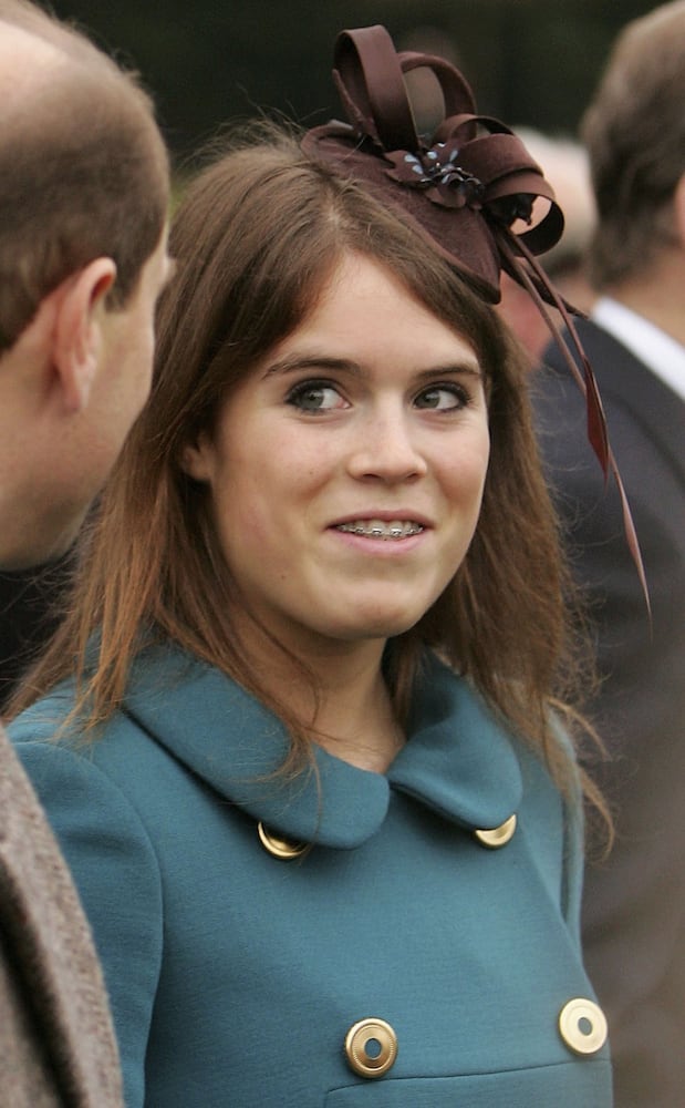 Celebrities who have had braces