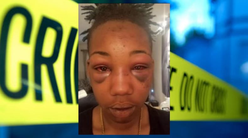 Tyra Rankin (Credit: Channel 2 Action News)