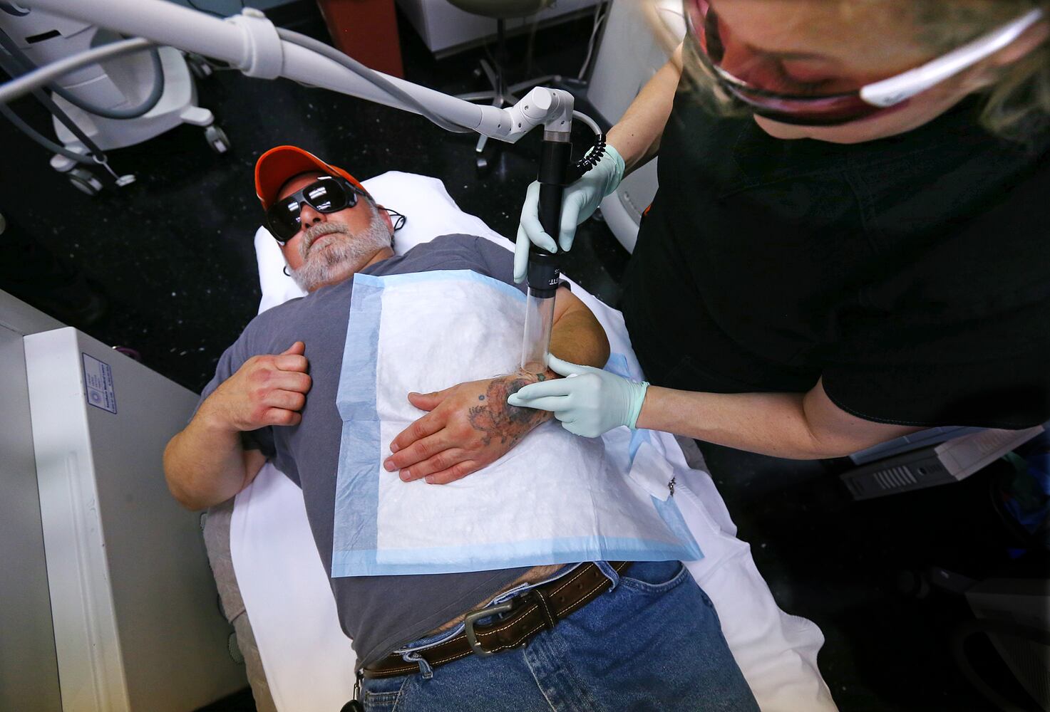 Tattoo removal Atlanta