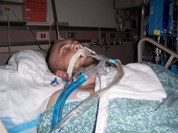 Jon Clark in Grady hospital, brain aneurysm