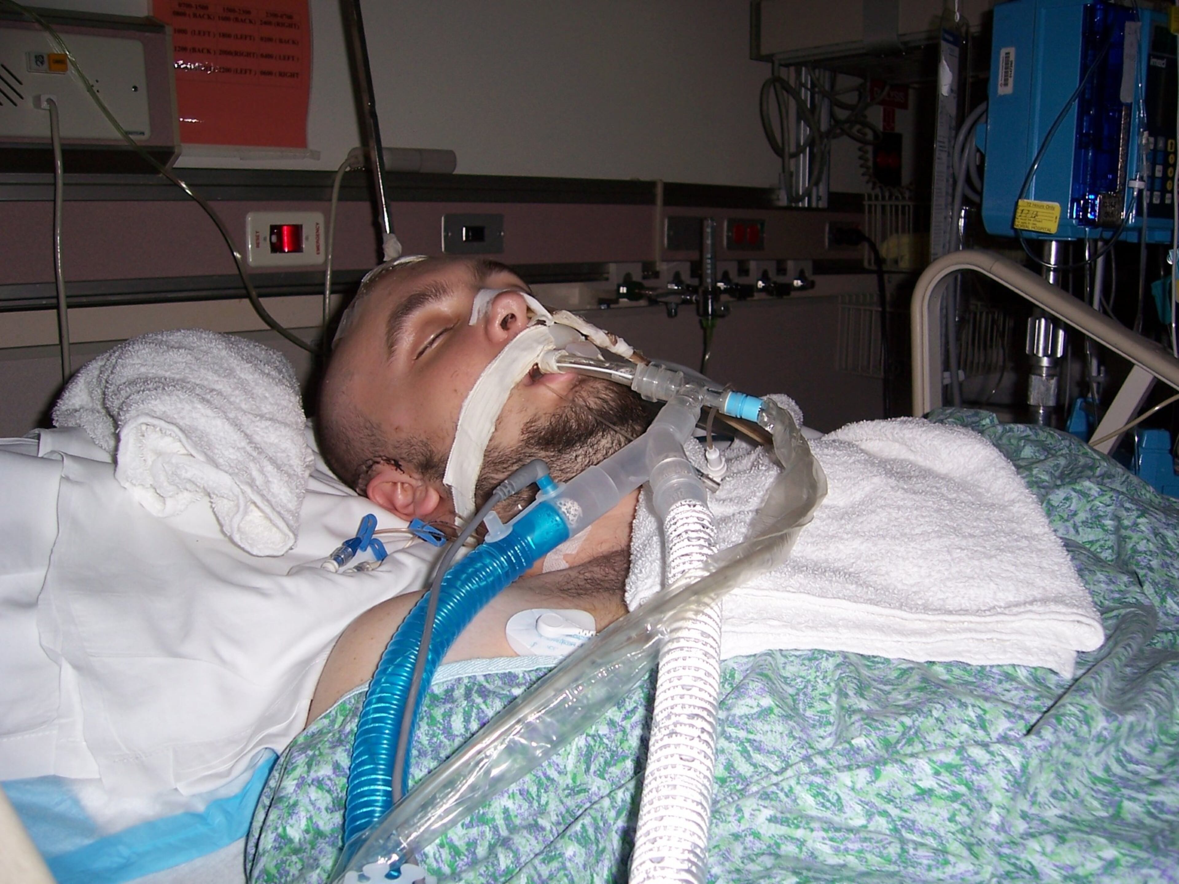 Jon Clark was a sophomore at the University of Georgia when he fell ill. (Courtesy of Jon Clark)