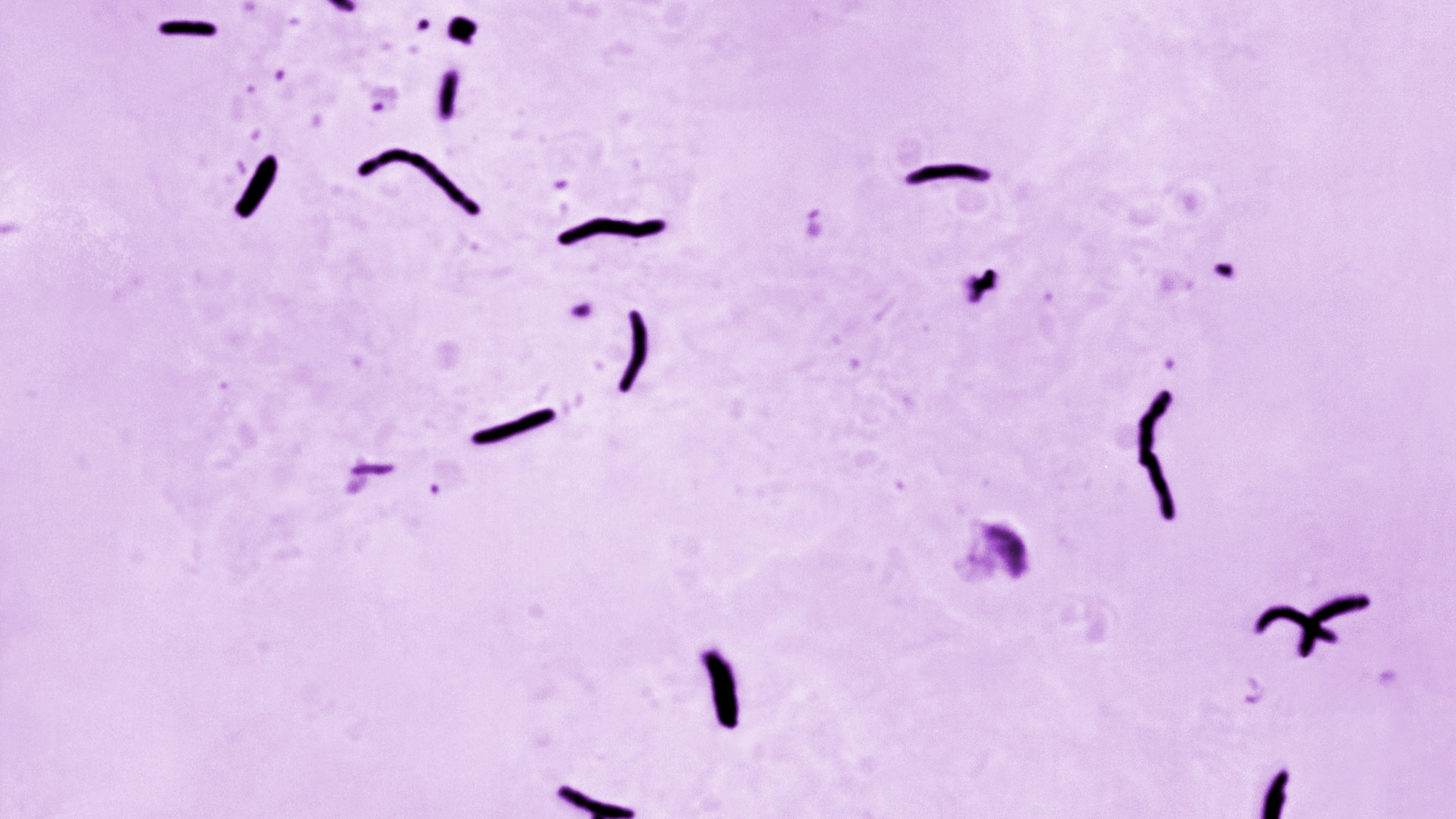 FILE - This 1966 microscope photo provided by the U.S. Centers for Disease Control and Prevention shows Mycobacterium tuberculosis bacilli, the organism responsible for causing the disease tuberculosis. (Elizabeth S. Mingioli/CDC via AP, File)