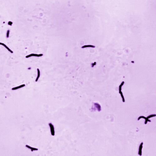 FILE - This 1966 microscope photo provided by the U.S. Centers for Disease Control and Prevention shows Mycobacterium tuberculosis bacilli, the organism responsible for causing the disease tuberculosis. (Elizabeth S. Mingioli/CDC via AP, File)