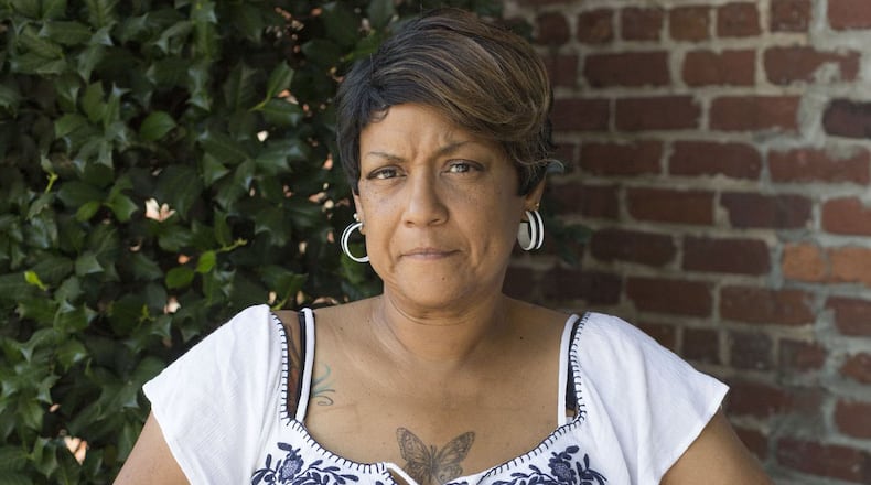 Doctors at Grady Memorial Hospital in Atlanta were forced to amputate Kimerly Finger’s right leg below the knee because of an infection that took hold months earlier while she was in prison. EMILY JENKINS/ EJENKINS@AJC.COM