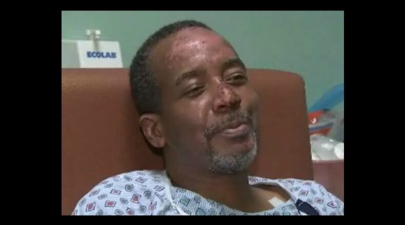 Ed Stroud recovers after being burned in a house fire. (Credit: Channel 2 Action News)