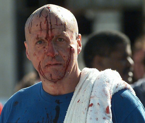FILE - An unidentified man, his face covered with blood, looks at the bombed Alfred P. Murrah Federal Building in Oklahoma City on April 19, 1995. (AP Photo/David Longstreath, File)