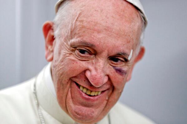 FILE - Pope Francis wears a plaster and has a bruised, black left eye and a cut on his eyebrow as he talks to journalists during a press conference on board the flight to Rome, at the end of a five-day visit to Colombia, where he banged his head on his popemobile when it stopped short amid swarms of well-wishers and he lost his balance, having only had a hip-high bar to hold onto, Monday, Sept. 11, 2017. (AP Photo/Andrew Medichini, pool, file)