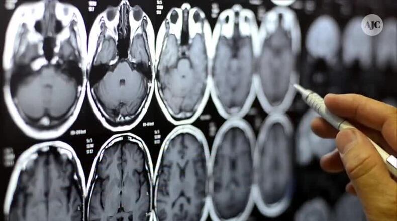 A doctor looks over brain scans