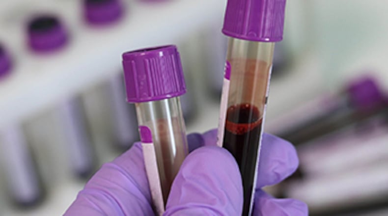 Alpharetta, with voluntary testing for first responders, reported 10 police officers and firefighters were found with SARS-CoV-2 antibodies, indicating past exposure to the COVID-19 virus. CITY OF ALPHARETTA